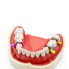 Impressive Smile Dental Wedge Knife DWG50 50 Piece Plastic Matrix-1