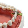 Shuodi Plastic Orthodontic Matrix Wedge Set with Stainless Steel Knife-4